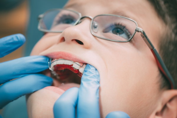 Ортодонтия, детская ортодонтия, исправление прикуса